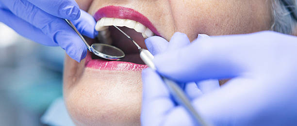Best Emergency Dental Care for Broken or Chipped Teeth in Bel Air North, MD